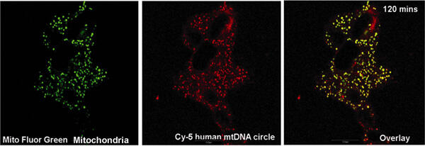 Entry of healthy human mitochondrial DNA into patient-derived cells. Shown in red is human mitochondrial DNA, and green is mitochondria. Image courtesy of Shilpa Iyer, Ph.D./VCU.