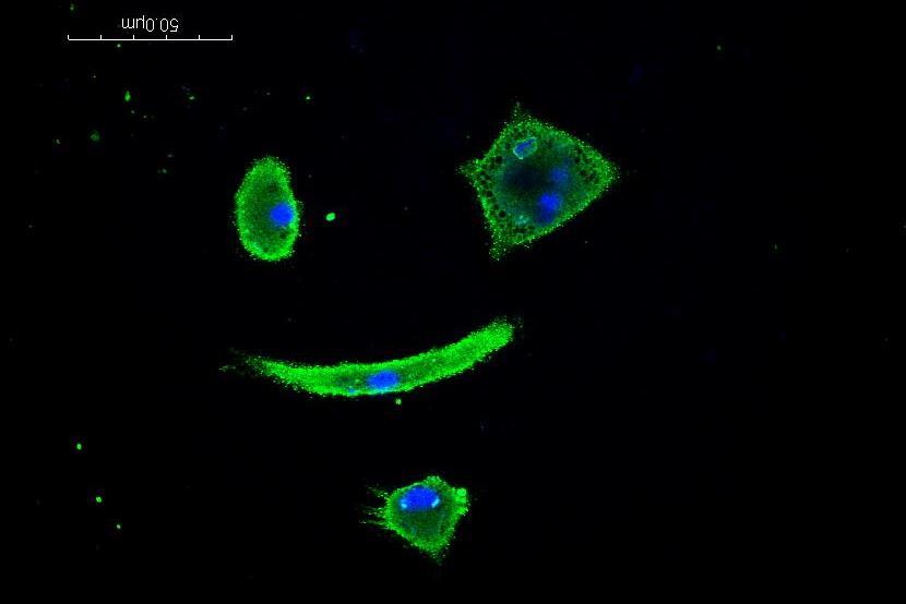 <p style="text-align: left;"><span style="font-family: sans-serif; font-size: large;"><strong>“Smiling Cells”<br /></strong></span><em>Tricia Hardt Smith, faculty instructor, Department of Biology, College of Humanities and Sciences</em></p>
<p style="text-align: left;"><span style="font-family: calibri;">Smith’s entry is the first picture to confirm the presence of Cannabinoid Receptor Interacting Protein 1a in gastrointestinal cells. The protein is stained in green while the blue represents cell nuclei. CRIP1a has previously been characterized in brain, eye and transfected cell culture systems.</span></p>
<p style="text-align: left;"><span style="font-family: calibri;">“CRIP1a has been shown to bind to the C-terminus of cannabinoid (CB1) receptors and inhibit constitutive CB1 receptor activity,” Smith said. “Cannabinoid receptors are found in the gut, and it is possible that CRIP1a is mediating receptor activity in the gut as well the brain.”</span>