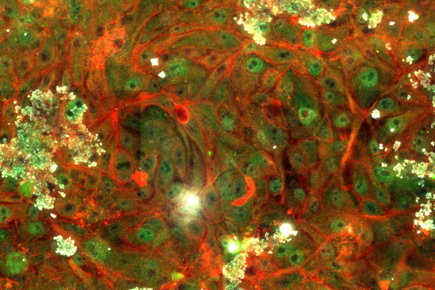 <p style="text-align: left;"><span style="font-family: sans-serif; font-size: large;"><strong>“Epithelial”<br /></strong></span><em>Roshni Malik, student, Department of Biomedical Engineering, School of Engineering</em></p>
<p style="text-align: left;"><span style="font-family: calibri;">Many cells are depicted in Malik’s image, demonstrating the presence of fibronectin in green. The darker regions are cell nuclei. This image is used in breast cancer research to explore the role of fibronectin in epithelial to mesenchymal transition.</span>