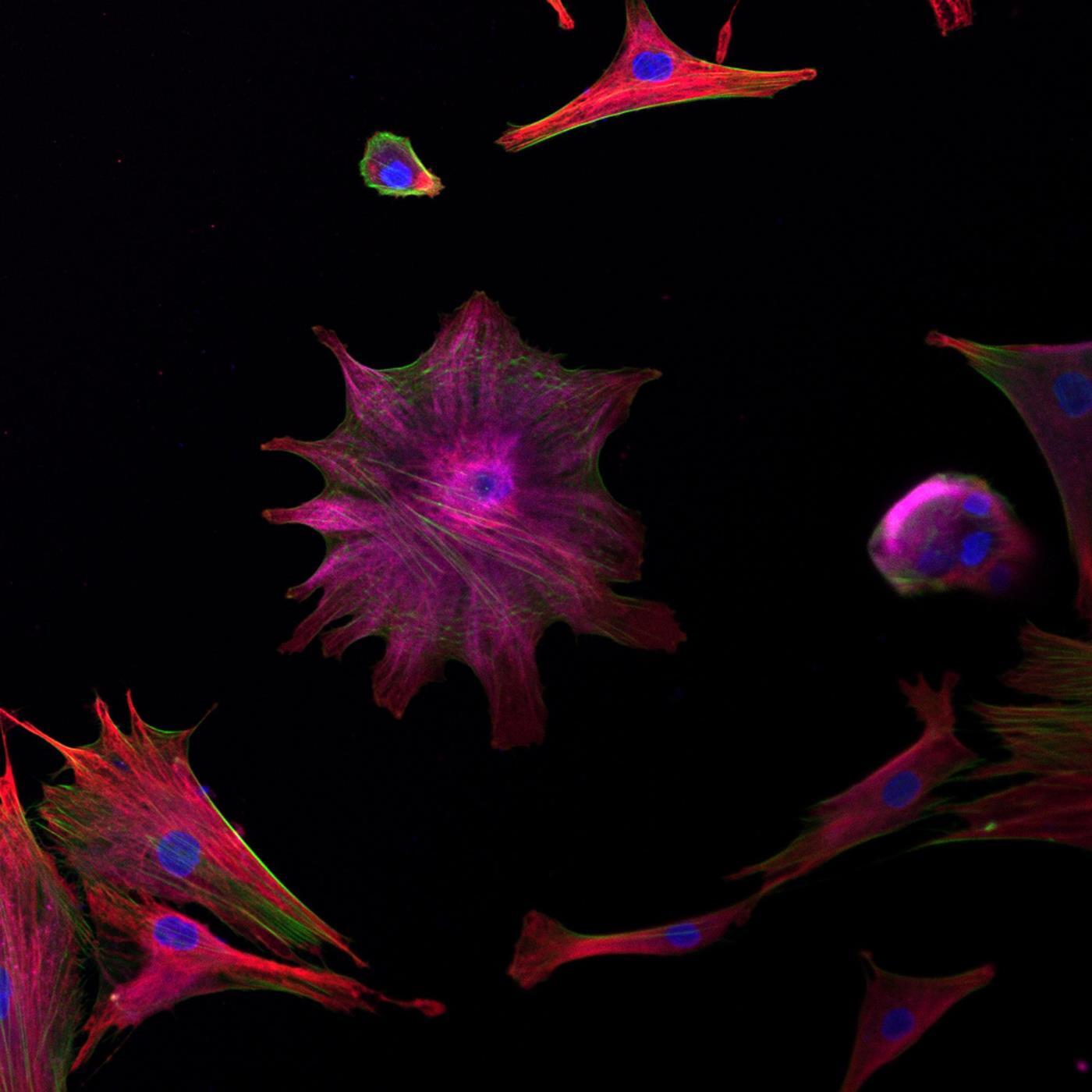 <p style="text-align: left;"><span style="font-family: sans-serif; font-size: large;"><strong>“My Little Jellyfish”</strong></span><br>
<em>Kelly Hotchkiss, student, Department of Biomedical Engineering, School of Engineering</em></p>
<p style="text-align: left;"><span style="font-family: calibri;">Hotchkiss’ image shows human mesenchymal stem cells that present a spread pattern of attachment after being prepared on a glass surface.</span>