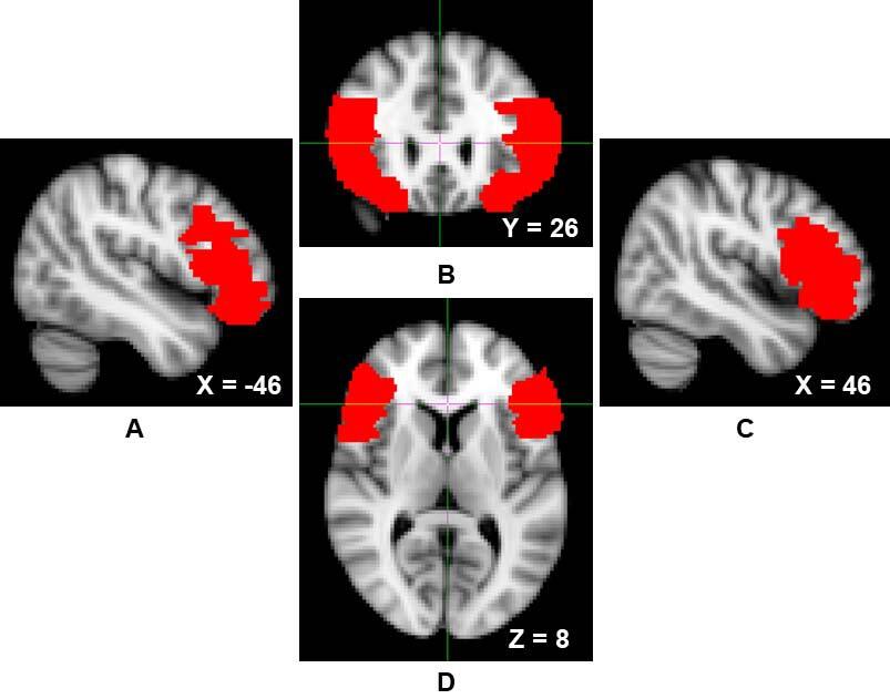 Four scans of the brain are displayed.