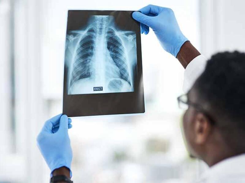Doctor looking at an x-ray image of a human chest
