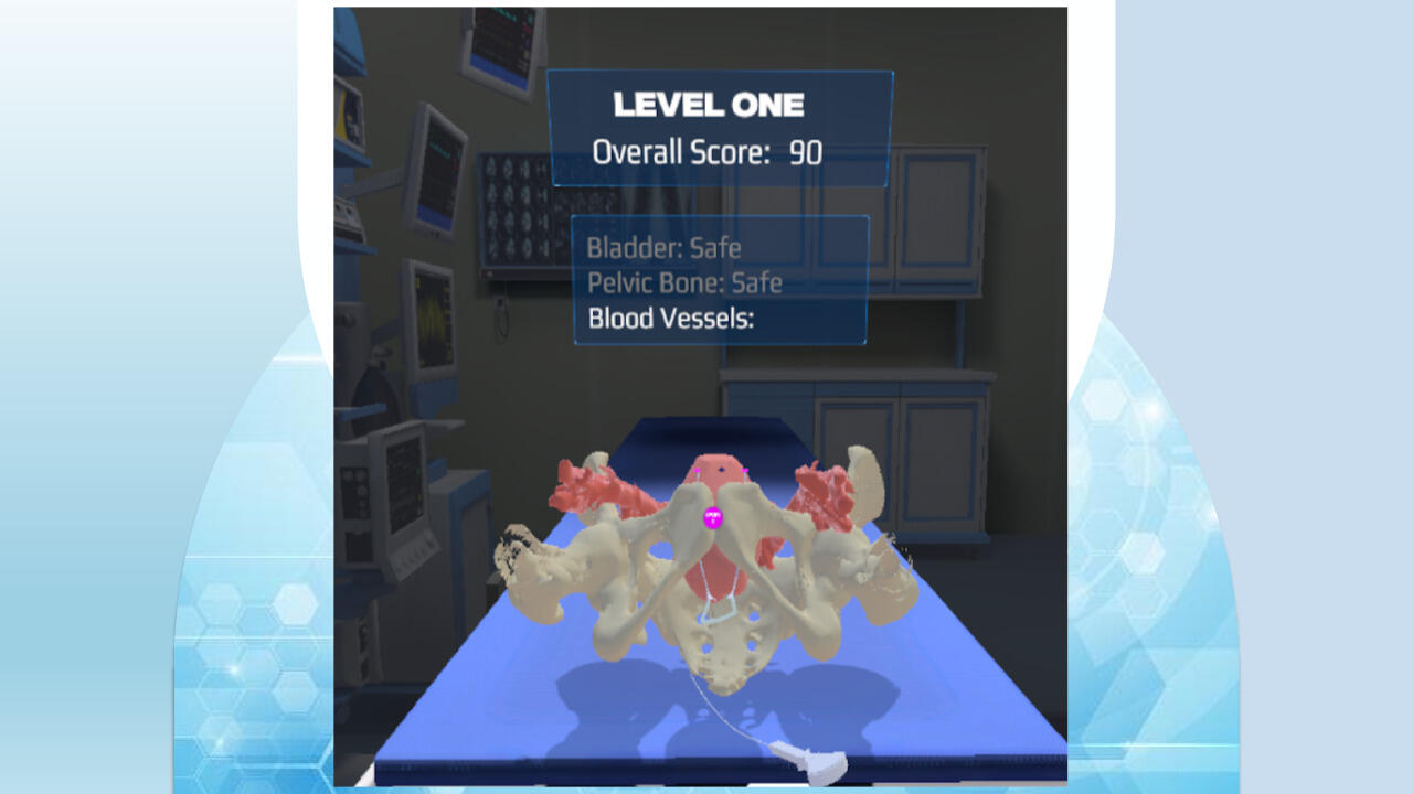 A photo of a screen showing a bone