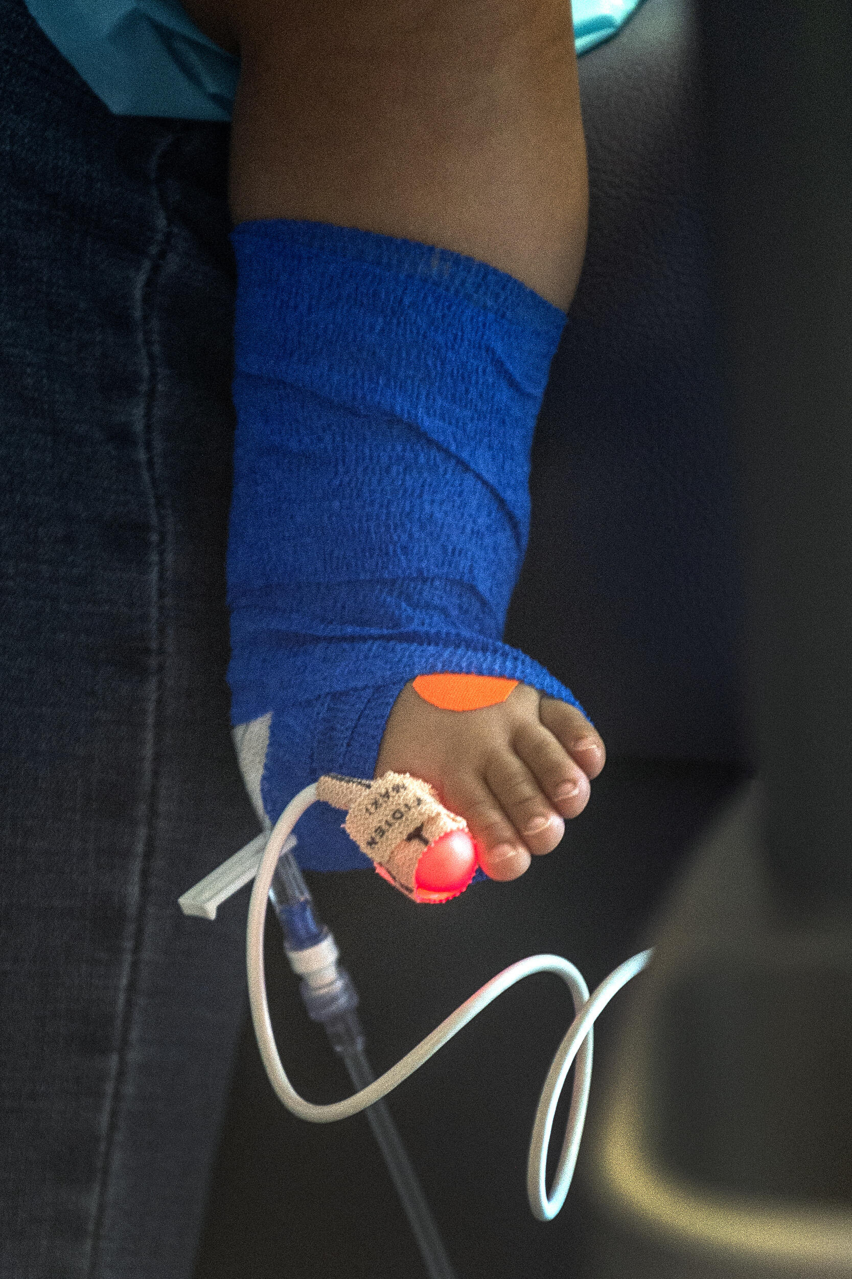 A child's foot with a monitor line attached to a toe.