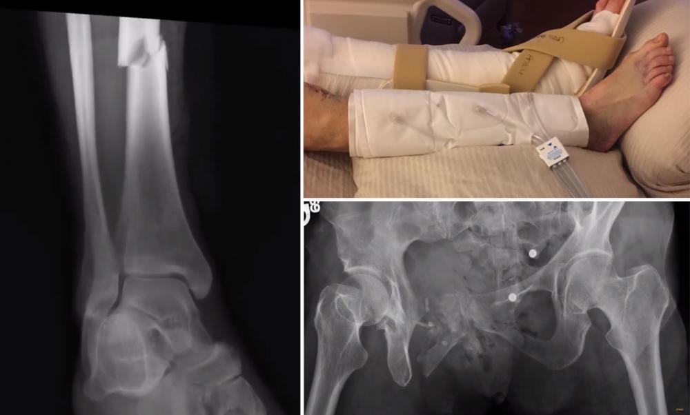 After a dire medical crisis, a family finds a way to say ‘thank you ...