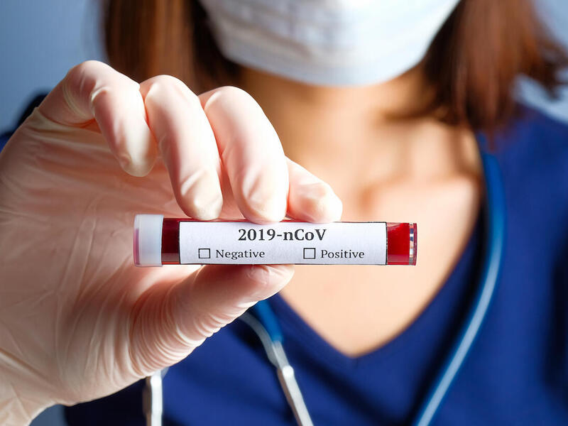 Doctor holding a COVID-19 test sample