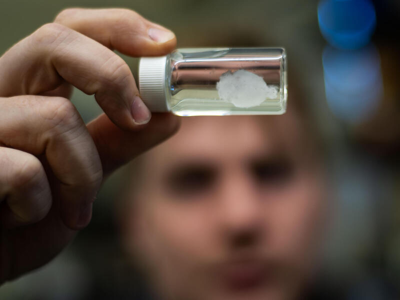 A photo of a small model brain in a jar being held by a person. 