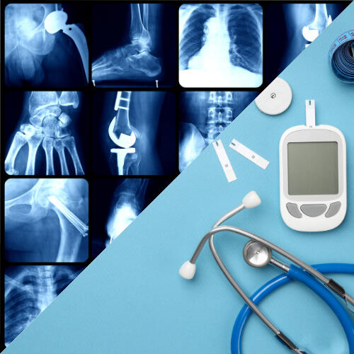 A split photo. On one side are x-ray images of different parts of the body. On the right is a stethoscope, glucose monitor, and testing strips. 