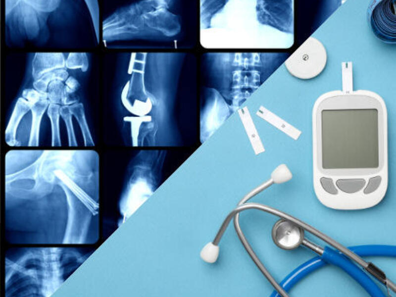 A split photo. On one side are x-ray images of different parts of the body. On the right is a stethoscope, glucose monitor, and testing strips. 