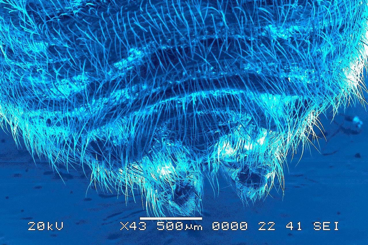 <p style="text-align: left;"><span style="font-family: sans-serif; font-size: large;"><strong>“The Abdomen of the Southern Black Widow”<br /></strong></span><em><span style="font-family: calibri;">Ryan Clohessy, student, </span><a href="http://biomedical.egr.vcu.edu/" target="_blank"><span style="color: blue; font-family: calibri;"><span style="text-decoration: underline;">Department of Biomedical Engineering</span></span></a><span style="font-family: calibri;">, </span><a href="http://www.egr.vcu.edu/" target="_blank"><span style="color: blue; font-family: calibri;"><span style="text-decoration: underline;">School of Engineering</span></span></a></em></p>
<p style="text-align: left;"><span style="font-family: calibri;">This image is a dorsal view of latrodectus mactans, or the southern black widow spider. The spider’s spinnerets – its silk-spinning organ – can be seen at the base of the abdomen.</span>