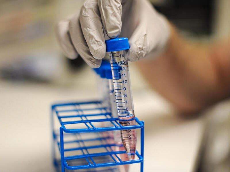 A hand placing a test tube into a holder.