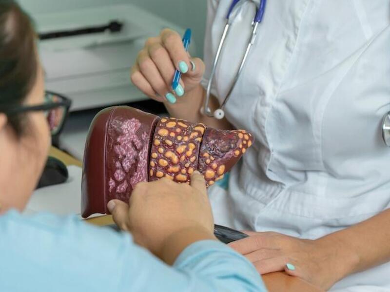 A photo of a two women pointing at a model of a liver with yellow blotches on it. 