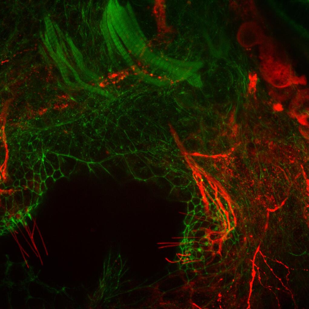 <p style="text-align: left;"><span style="font-family: sans-serif; font-size: large;"><strong>“Ear”</strong></span><br /><em><a href="http://biology.vcu.edu/people/robert-tombes" target="_blank"><span style="color: blue; font-family: calibri;"><span style="text-decoration: underline;">Robert Tombes</span></span></a><span style="font-family: calibri;">, Ph.D., professor, </span><a href="http://biology.vcu.edu/" target="_blank"><span style="color: blue; font-family: calibri;"><span style="text-decoration: underline;">Department of Biology</span></span></a><span style="font-family: calibri;">, </span><a href="http://www.has.vcu.edu/" target="_blank"><span style="color: blue; font-family: calibri;"><span style="text-decoration: underline;">College of Humanities and Sciences</span></span></a></em></p>
<p style="text-align: left;"><span style="font-family: calibri;">“Ear” shows muscle fibers (in green) and tubulin (in red), portraying the “axonal innervation of the ear into sensory structures.” According to the exhibit’s display, the image “suggests novel ways to regrow auditory sensors within the inner ear.”</span>