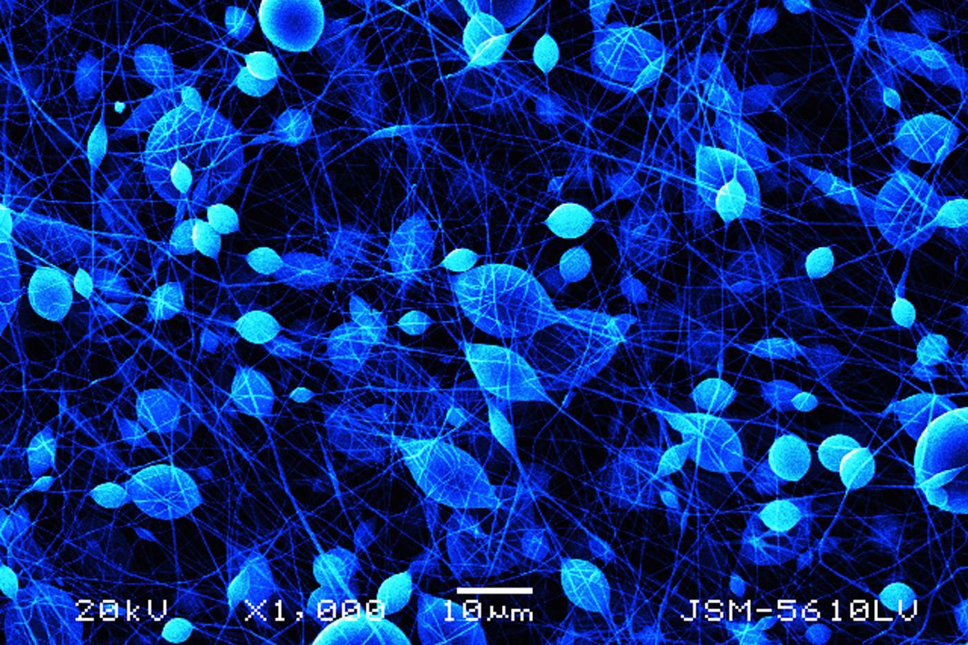 <p style="text-align: left;"><span style="font-family: sans-serif; font-size: large;"><strong>“Electrospun Fibers”<br /></strong></span><em>Ryan Clohessy, student, Department of Biomedical Engineering, School of Engineering</em></p>
<p style="text-align: left;"><span style="font-family: calibri;">This image shows electrospun fibers that were created in an effort to develop a scaffold suitable for tissue engineering. The image was one of three selected as prizewinners by the judges.</span></p>
<p style="text-align: left;"><span style="font-family: calibri;">“I think combining science and artistic creativity has led to some amazing images and hope the beauty that can be found in science continues to be recognized and appreciated,” Clohessy said, after his image was selected as a prizewinner.</span>