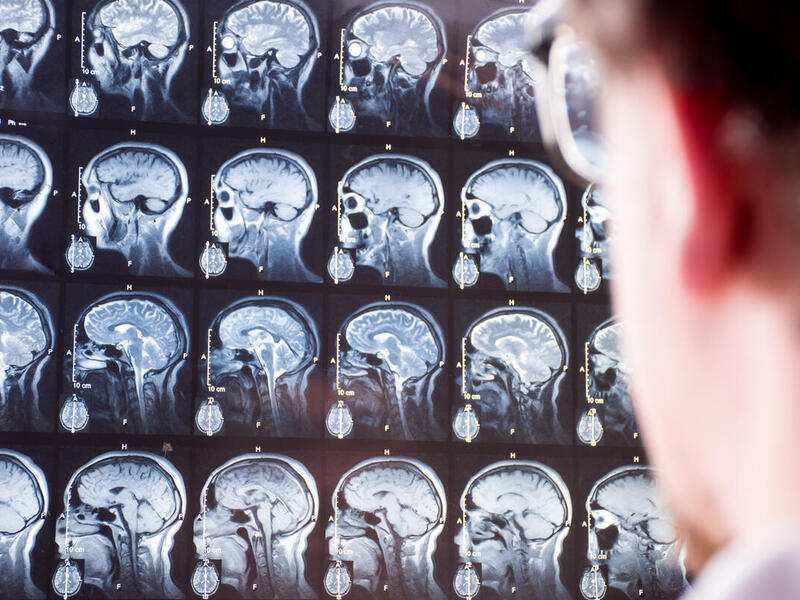 Doctor looking at brain scans. 