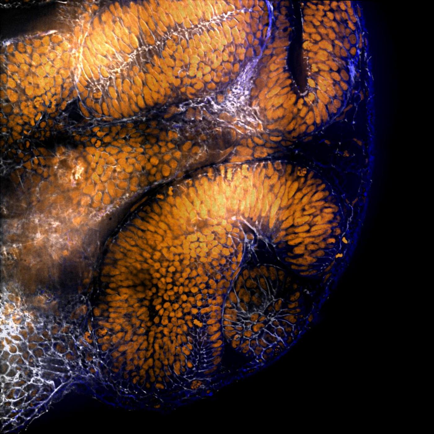 <p style="text-align: left;"><span style="font-family: sans-serif; font-size: large;"><strong>“Visualizing Vision”<br /></strong></span><em>Paul Vorster, Ph.D. student, </em><em><a href="http://www.vcu.edu/lifesci/phd/" target="_blank"><span style="color: blue; font-family: calibri;"><span style="text-decoration: underline;">Integrative Life Sciences</span></span></a><span style="font-family: calibri;">, </span><a href="http://www.vcu.edu/lifesci/" target="_blank"><span style="color: blue; font-family: calibri;"><span style="text-decoration: underline;">VCU Life Sciences</span></span></a></em></p>
<p style="text-align: left;"><span style="font-family: calibri;">“Visualizing Vision” shows an array of retina cells surrounding the lens during eye development in a zebrafish embryo. The image was taken at the embryonic developmental stage relevant to retina and lens development in zebrafish at 24 hours post-fertilization.</span>