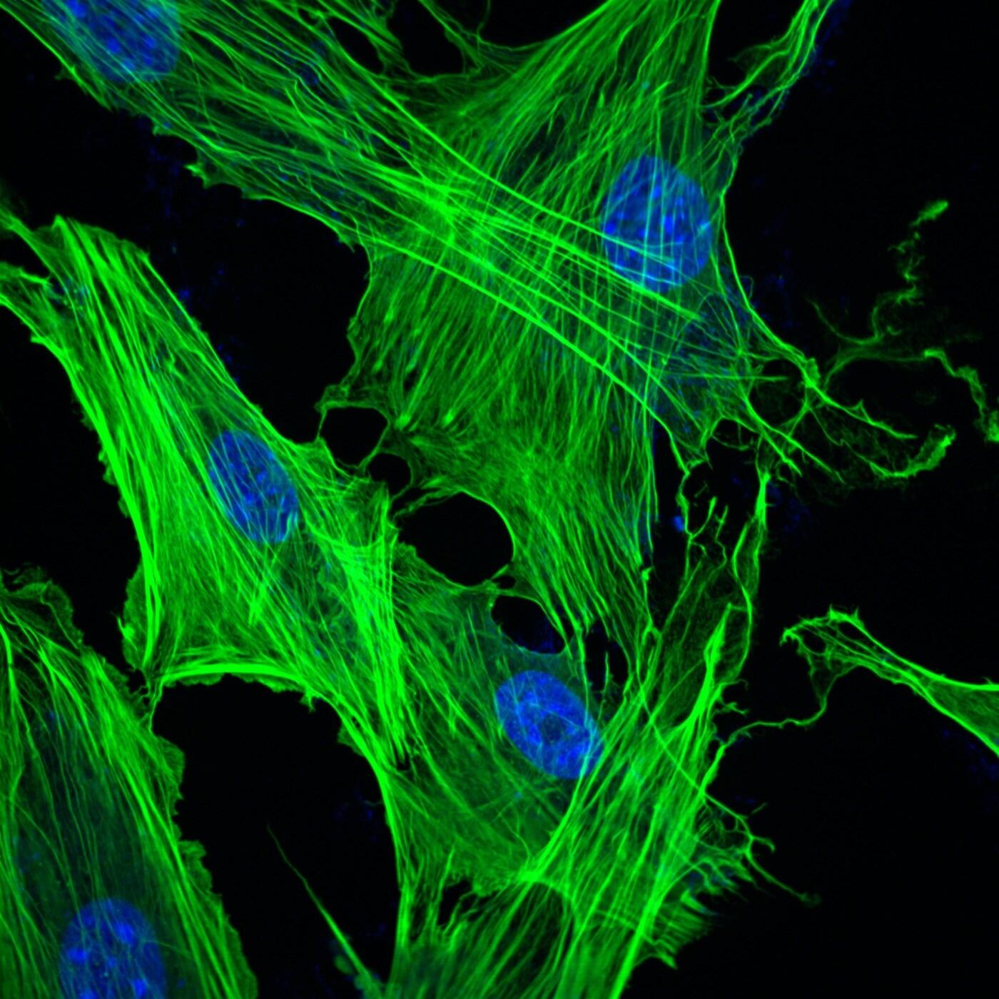 <p style="text-align: left;"><span style="font-family: sans-serif; font-size: large;"><strong>“Actin Reorganization in Transgenic Mouse Lung Cells”<br /></strong></span><em>Shilpa Singh, student, </em><em><a href="http://www.biochemistry.vcu.edu/" target="_blank"><span style="color: blue; font-family: calibri;"><span style="text-decoration: underline;">Department of Biochemistry and Molecular Biology</span></span></a><span style="font-family: calibri;">, School of Medicine</span></em></p>
<p style="text-align: left;"><span style="font-family: calibri;">These transgenic mice lung cells were stained using phalloidin and mounted using DAPI – a fluorescent stain – at 40-times magnification.</span>