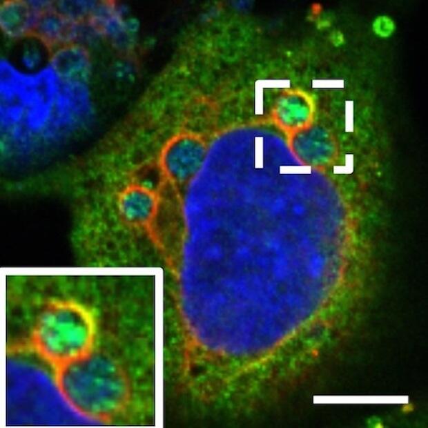 Bacteria living in vacuoles, noted by red circles, inside a tissue culture cell, the nucleus of which is blue. 