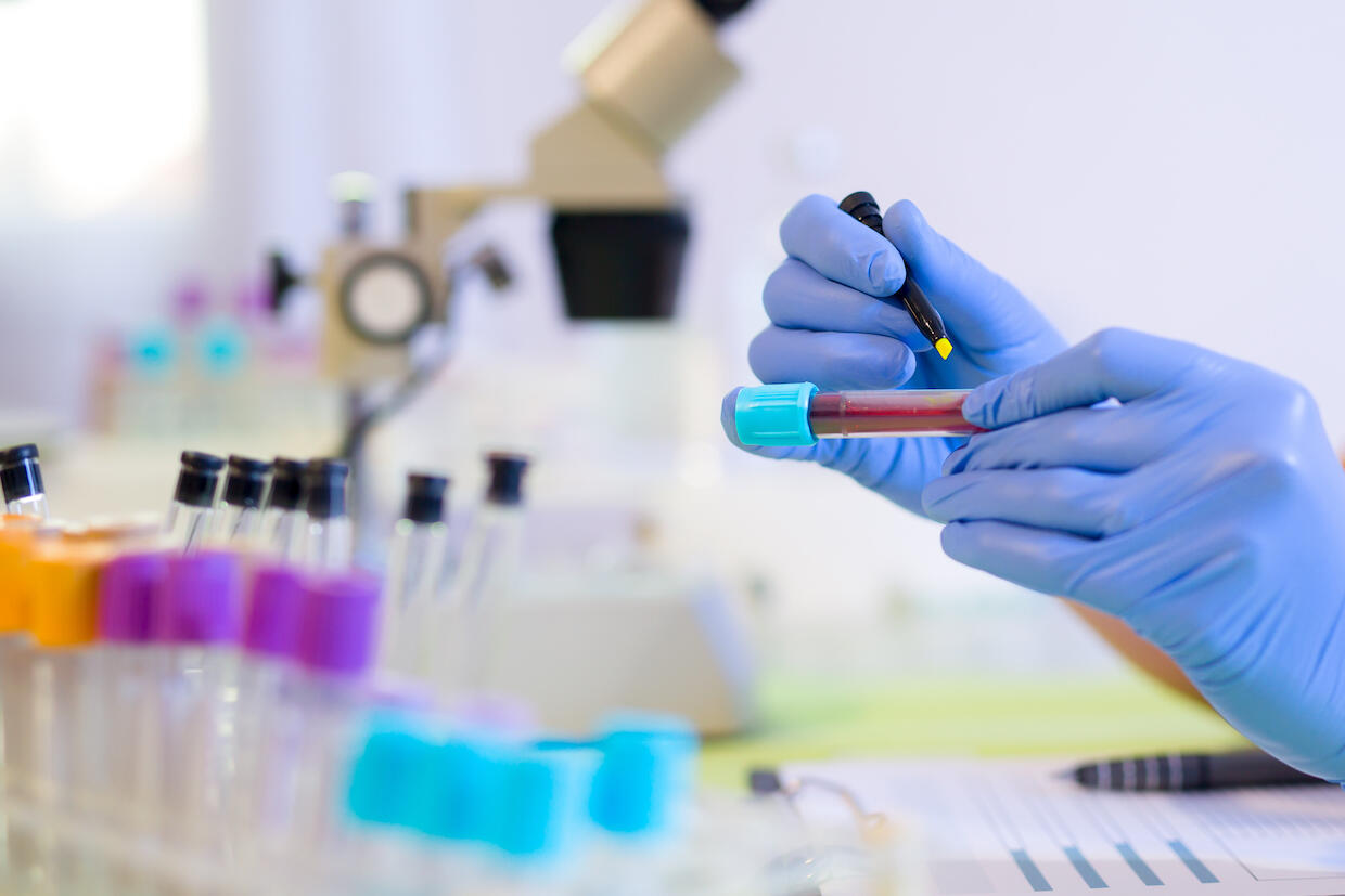 A person marks a vial of blood.