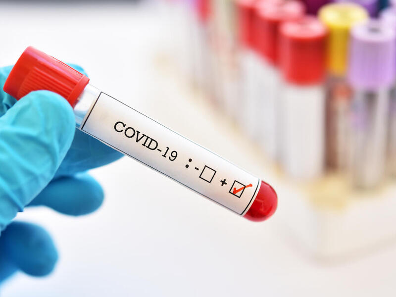 A blood sample vial with COVID-19 written on the side.