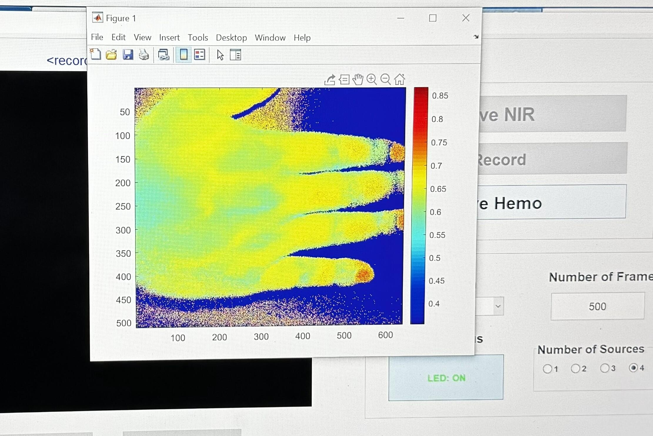 Imaging on a computer screen shows details of a hand.