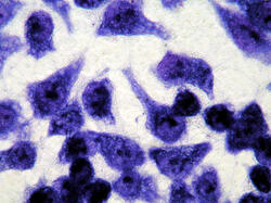 Trypanosoma cruzi at work. Image courtesy of Tarynn Witten, Ph.D., VCU