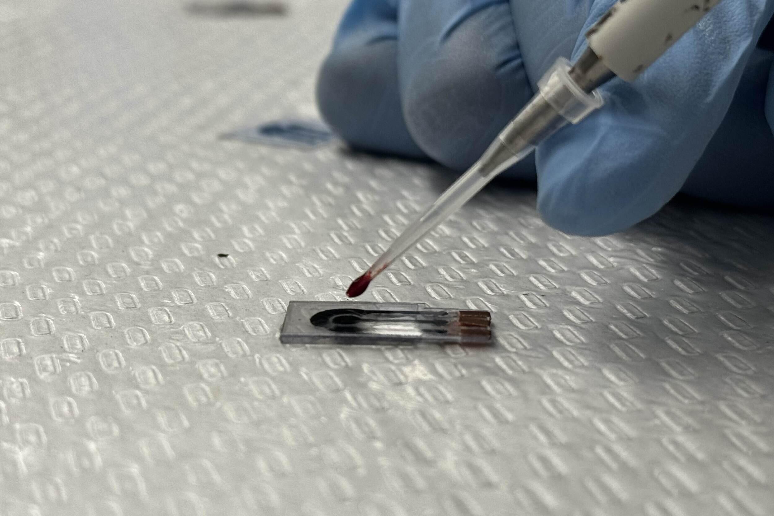 A photo of a hand wearing a blue latex blood putting droplets of blood on a small flat object. 