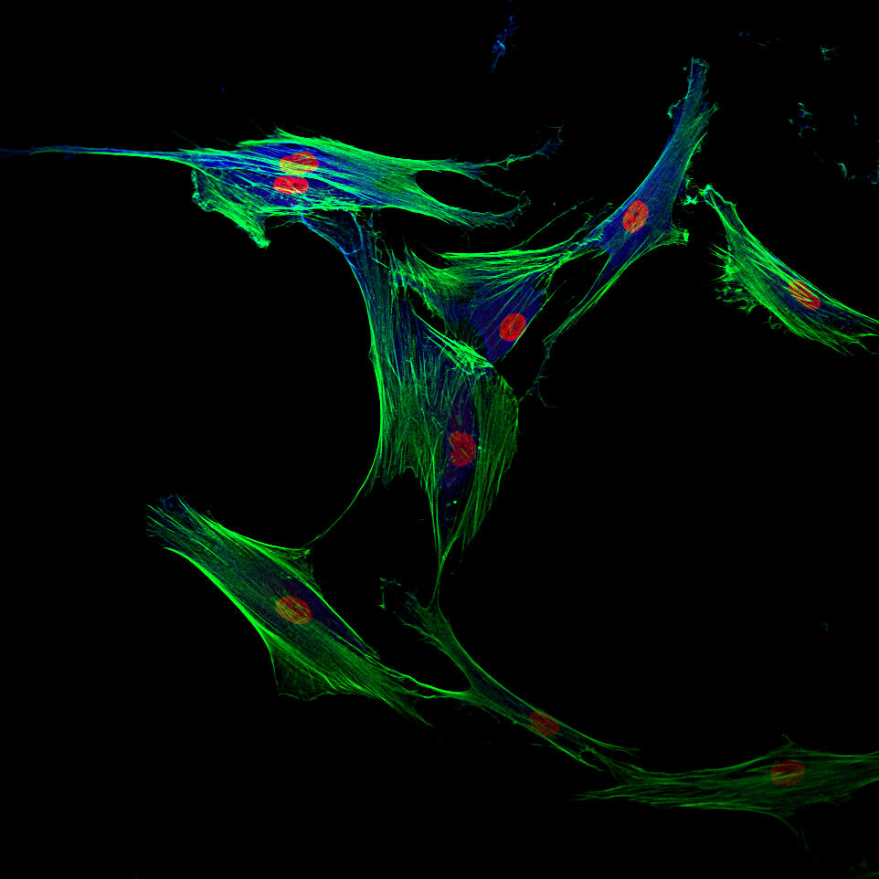 <p style="text-align: left;"><span style="font-family: sans-serif; font-size: large;"><strong>“A Gathering of Osteoblasts”<br /></strong></span><em>Gireesh Reddy, student, Department of Biomedical Engineering, School of Engineering</em></p>
<p style="text-align: left;"><span style="font-family: calibri;">This image aims to provide insight into the distribution of integrin alpha V (stained in blue) in the cell.</span>