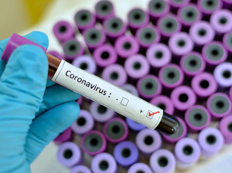 A vial with the word \"coronavirus\" listed.